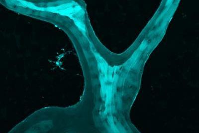 Bone-research-could-yield-stronger-synthetic-materials