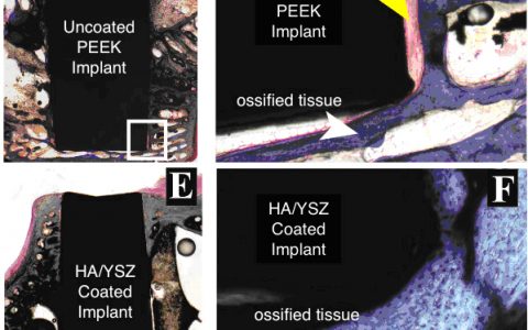当PEEK遭遇生物活性薄膜涂层,可与骨头分外亲密