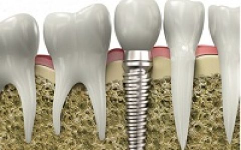 Sci. Adv. 在Ti-Au合金体系中发现超高硬度生物材料