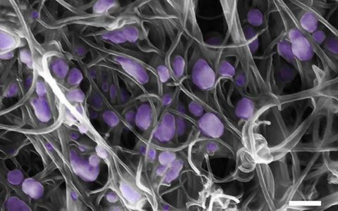 不再怕病毒大爆发！用于超灵敏病毒探测和鉴定的新型碳纳米管工具