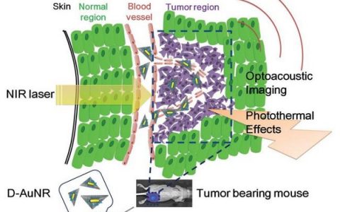 Adv. Mater. DNA纳米结构-金纳米棒杂化用来增强体内光声成像和光热治疗效果