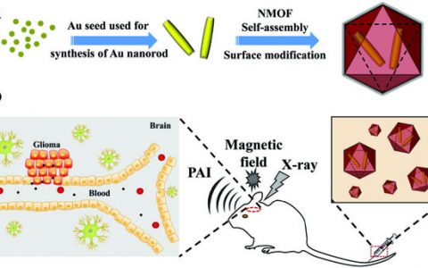 Adv. Mater. 核壳结构Au@MOF纳米探针用于神经胶质瘤的多模态诊断