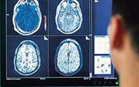 超导铋“便宜”了核磁共振扫描仪