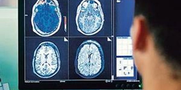 tifr-scientists-find-bismuth-superconductor-can-lower-mri-cost-100-times-indialivetoday