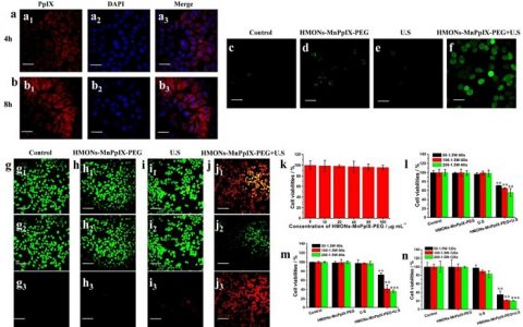 JACS:金属卟啉包裹的可生物降解纳米系统用于核磁引导的声动力肿瘤治疗