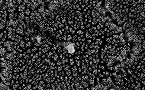 疏血肽——抵抗排异的救命肽