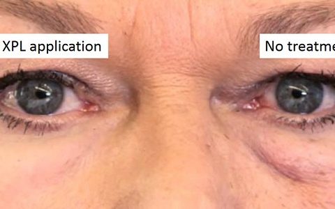 MIT研制出可以紧致皮肤的美容材料