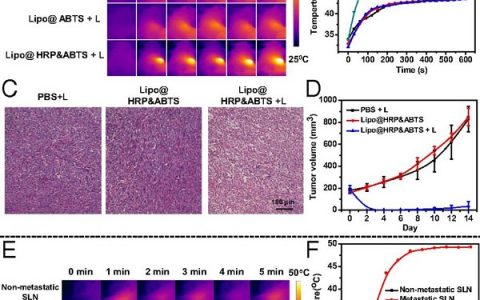 PNAS：过氧化氢响应性脂质体纳米探针通过体内显色测定用于光声炎症成像和肿瘤诊疗