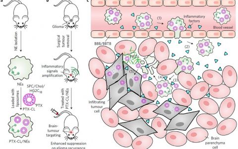 中国药科大学张灿团队Nature Nanotechnology：利用免疫细胞递送药物抑制脑胶质瘤的术后复发