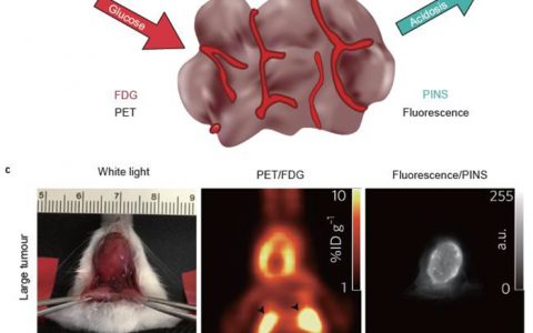 Natl. Sci. Rev.刘庄综述：肿瘤酸性微环境响应性纳米诊疗平台的构建新思路