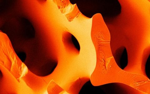 受海胆刺启发的新型水泥