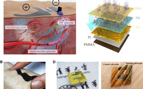 清华大学冯雪团队Sci. Adv.：类皮肤柔性电子器件实现医疗级无创血糖监测