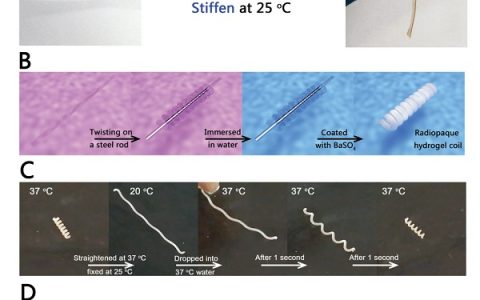 天大Adv. Funct. Mater.:刚性形状记忆水凝胶弹簧圈成功实现肾动脉栓塞