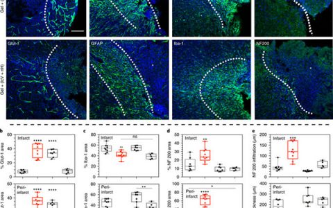 Nat. Mater.:双功能可注射血管生成生物材料用于中风脑组织修复
