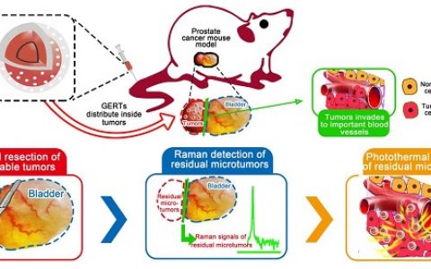 ACS Nano：缝隙增强拉曼探针用于术中残留微小肿瘤灶的检测和根除