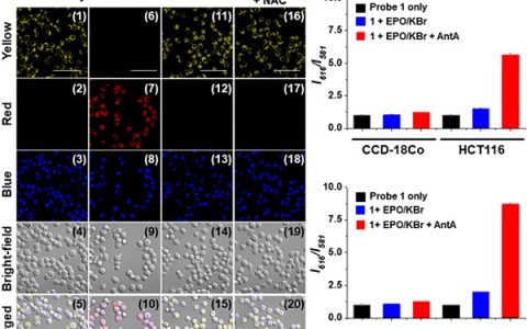 韩国庆熙大学Youngmi Kim课题组J. Am. Chem. Soc.: 通过J聚体荧光探针选择性追踪嗜酸粒细胞过氧化酶活性